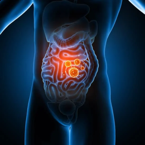 Uncovering the Importance of Gut Health